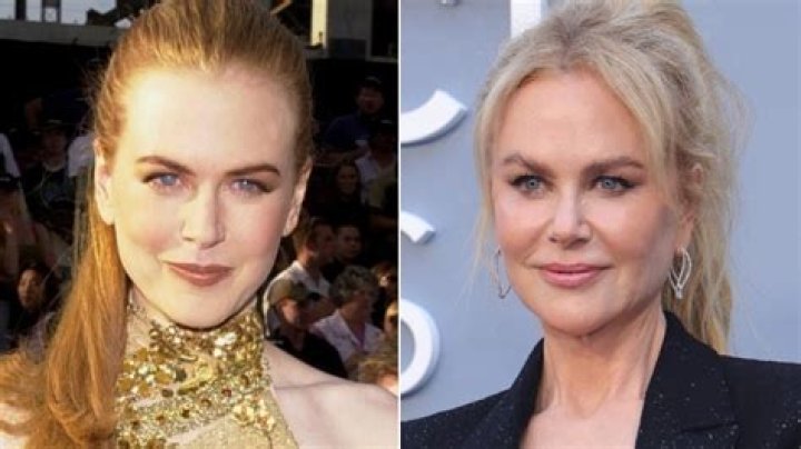 Does Nicole Kidman Have Implants: The Untold Truth