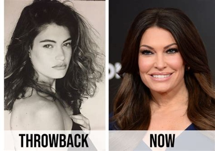 Kimberly Guilfoyle's Transformation: Before And After Photos Revealed