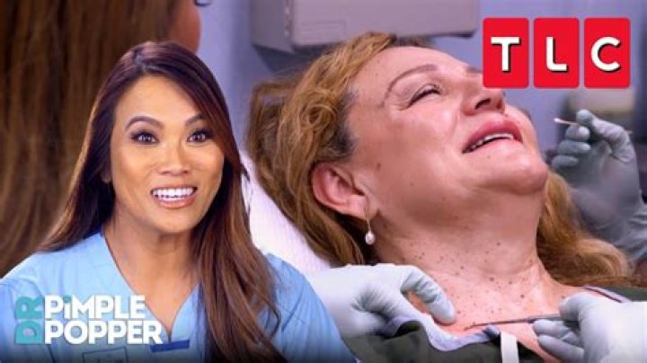 Watch Dermatologist Dr. Pimple Popper Treat Patient Roger | Pimple Popping Videos
